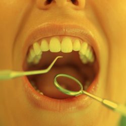 Rendez-vous avec l'hygiéniste de la clinique dentaire FluOr à Bienne